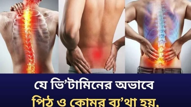 যে ভিটা’মিনের অভাবে পিঠ ও কো’মর ব্য’থা হয়, জেনে নিন!
